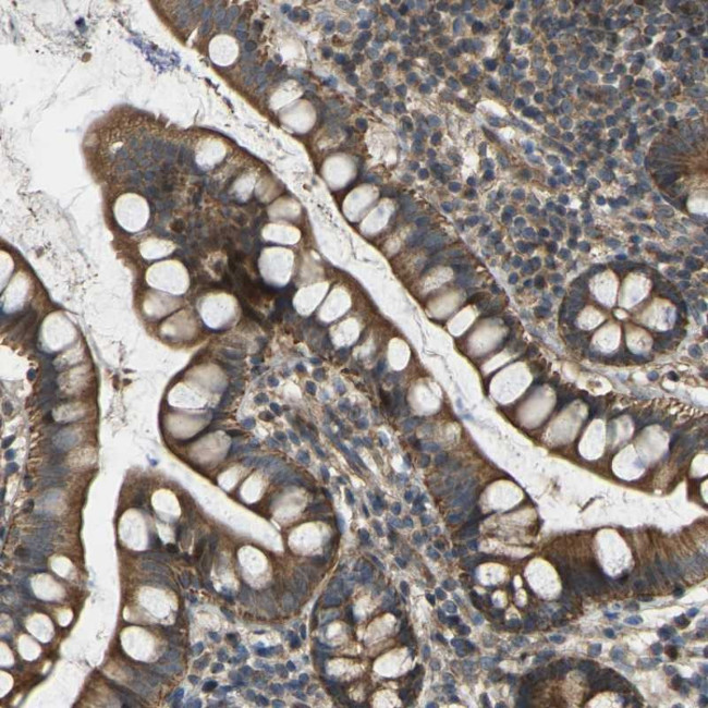 C21orf91 Antibody in Immunohistochemistry (Paraffin) (IHC (P))
