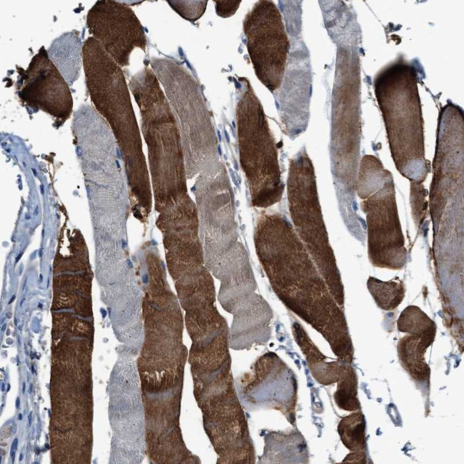 RWDD2B Antibody in Immunohistochemistry (Paraffin) (IHC (P))