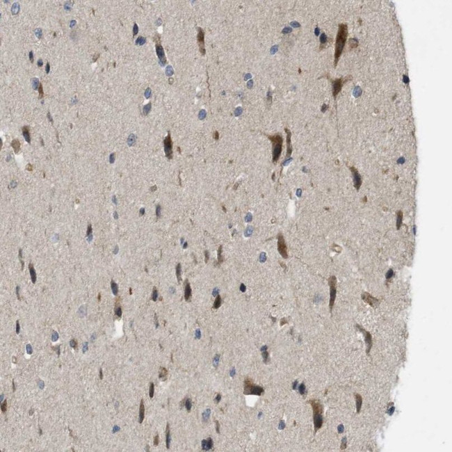 CALHM1 Antibody in Immunohistochemistry (IHC)