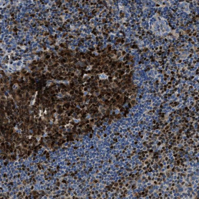 TOX Antibody in Immunohistochemistry (IHC)