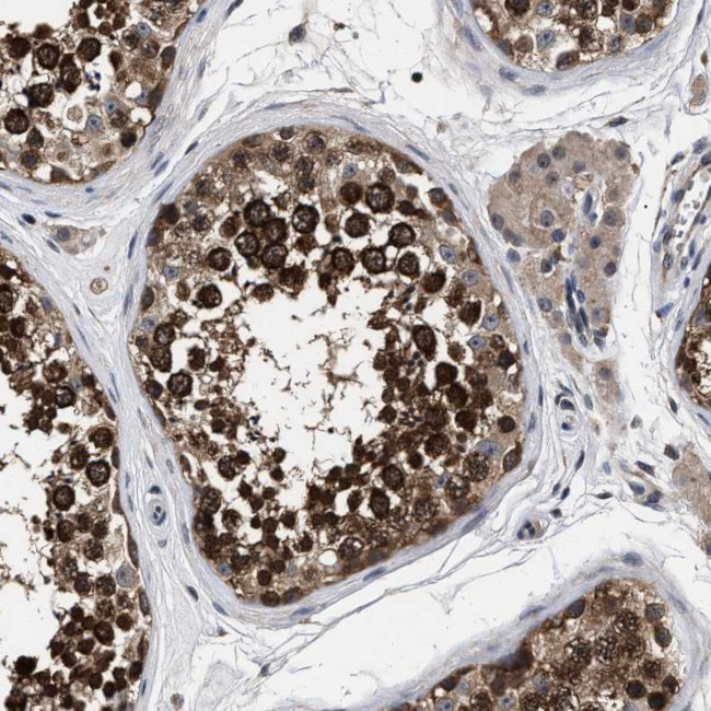 UPF3A Antibody in Immunohistochemistry (Paraffin) (IHC (P))