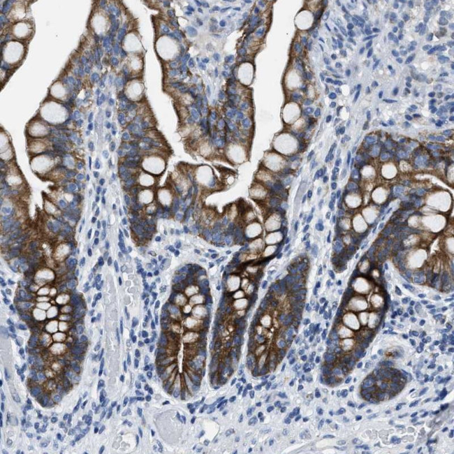 MRPL39 Antibody in Immunohistochemistry (Paraffin) (IHC (P))