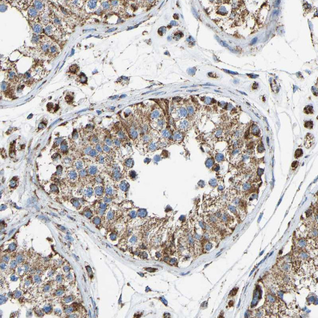 IRX6 Antibody in Immunohistochemistry (Paraffin) (IHC (P))