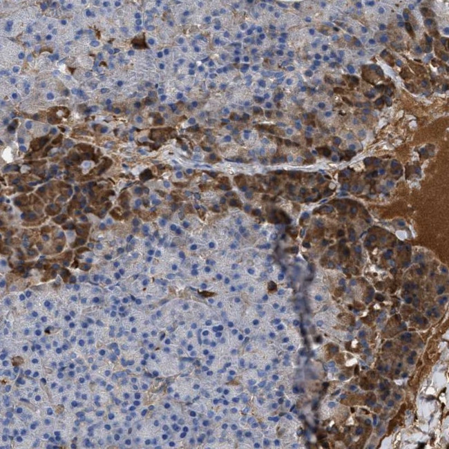 BTG3 Antibody in Immunohistochemistry (Paraffin) (IHC (P))