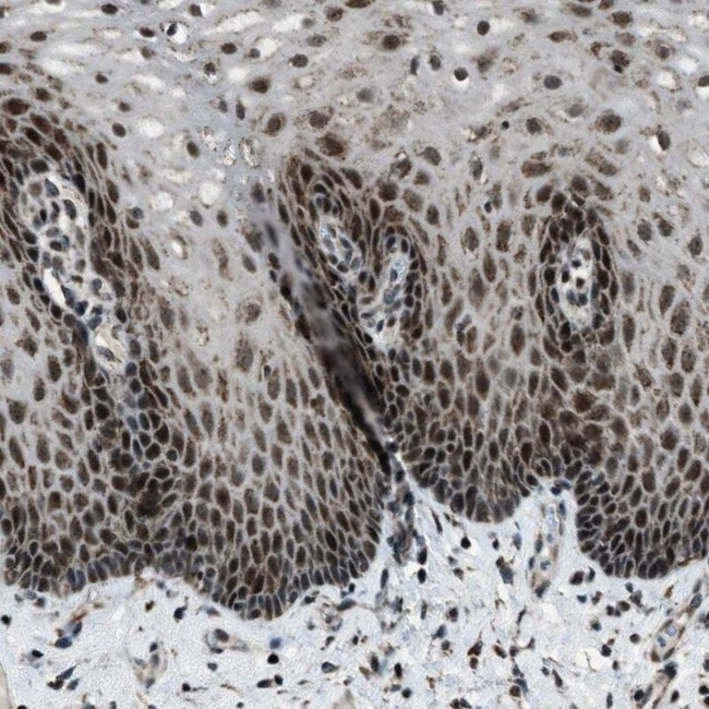 MORC3 Antibody in Immunohistochemistry (IHC)