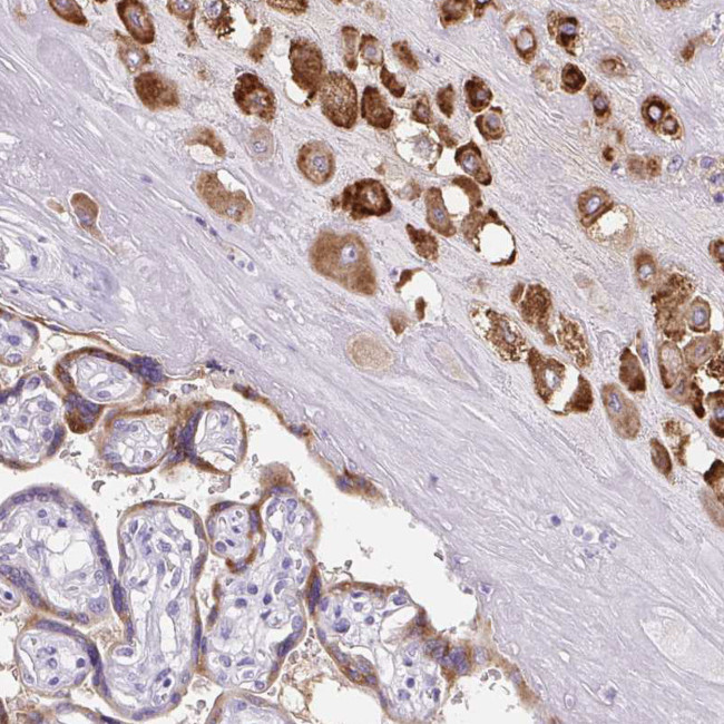 PAPPA2 Antibody in Immunohistochemistry (Paraffin) (IHC (P))