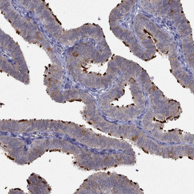 RTDR1 Antibody in Immunohistochemistry (Paraffin) (IHC (P))