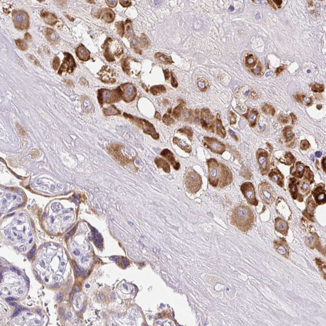 PAPPA2 Antibody in Immunohistochemistry (Paraffin) (IHC (P))