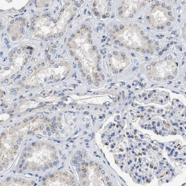 Importin 8 Antibody in Immunohistochemistry (IHC)