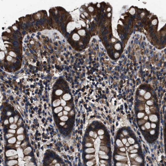 HSCB Antibody in Immunohistochemistry (Paraffin) (IHC (P))