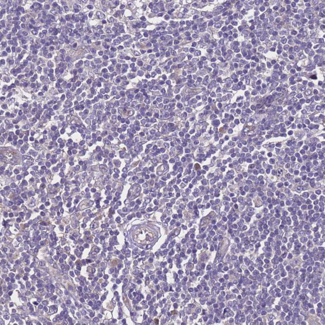 ZNF248 Antibody in Immunohistochemistry (Paraffin) (IHC (P))