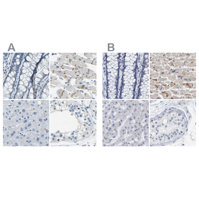 XIRP1 Antibody in Immunohistochemistry (IHC)