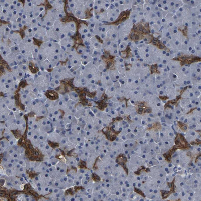 DSCR4 Antibody in Immunohistochemistry (Paraffin) (IHC (P))