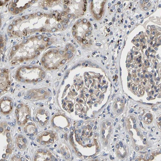 TMEM38B Antibody in Immunohistochemistry (IHC)
