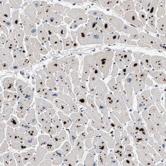 PDP1 Antibody in Immunohistochemistry (Paraffin) (IHC (P))