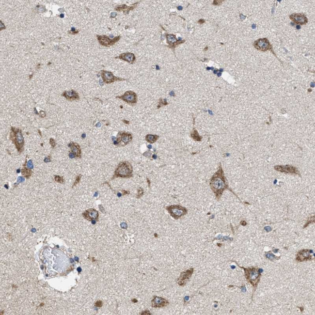 C14orf145 Antibody in Immunohistochemistry (Paraffin) (IHC (P))