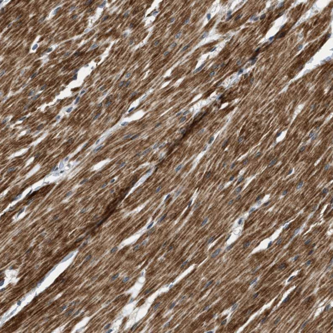 MTMR1 Antibody in Immunohistochemistry (Paraffin) (IHC (P))