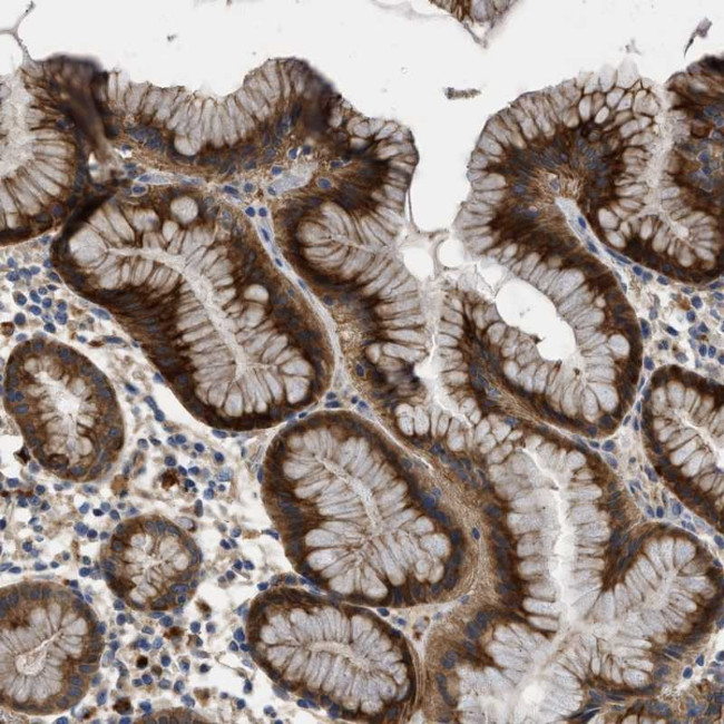 TAIP12 Antibody in Immunohistochemistry (Paraffin) (IHC (P))