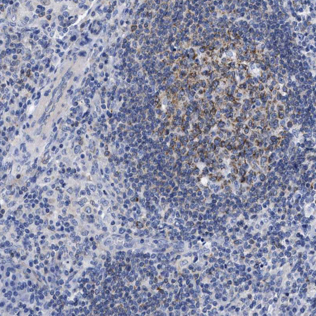 Lrmp Antibody in Immunohistochemistry (Paraffin) (IHC (P))