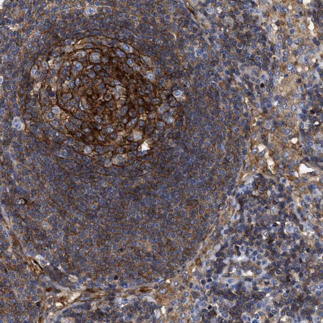 SIT Antibody in Immunohistochemistry (Paraffin) (IHC (P))