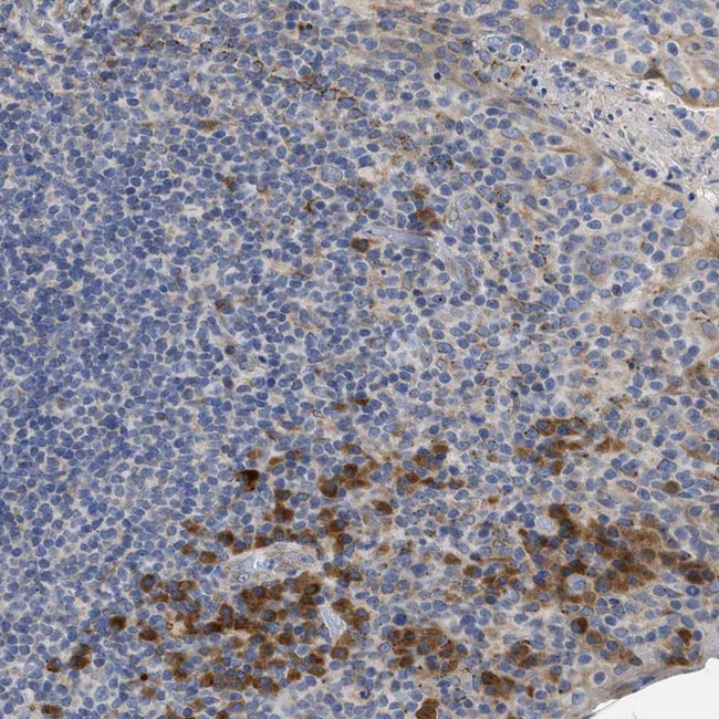 TMED1 Antibody in Immunohistochemistry (Paraffin) (IHC (P))