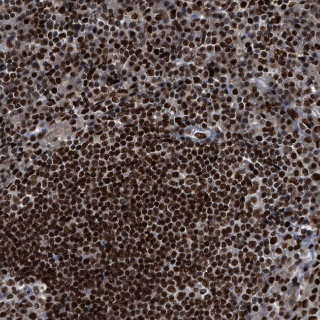 RFX5 Antibody in Immunohistochemistry (Paraffin) (IHC (P))