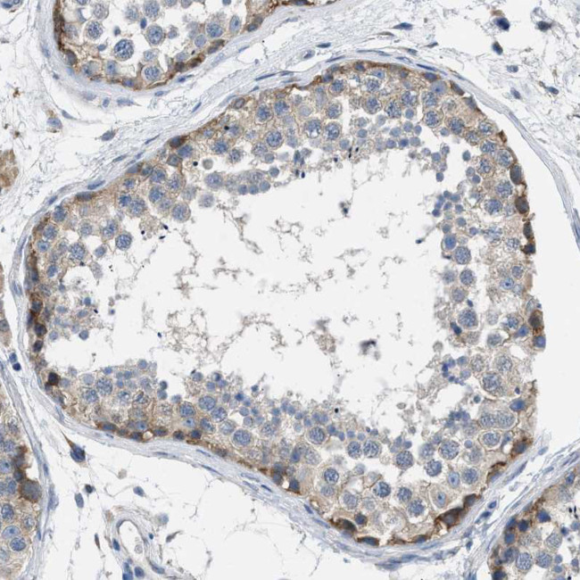 BNC2 Antibody in Immunohistochemistry (Paraffin) (IHC (P))