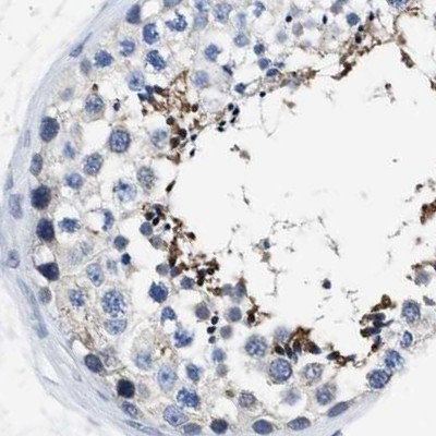 HOOK1 Antibody in Immunohistochemistry (Paraffin) (IHC (P))