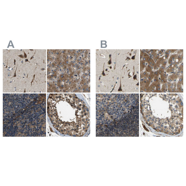 ERGIC1 Antibody in Immunohistochemistry (IHC)