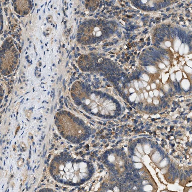 BCL7C Antibody in Immunohistochemistry (Paraffin) (IHC (P))