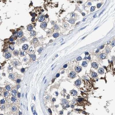 HOOK1 Antibody in Immunohistochemistry (Paraffin) (IHC (P))