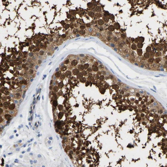 NKAIN3 Antibody in Immunohistochemistry (Paraffin) (IHC (P))