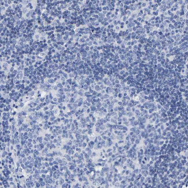 A33 Antibody in Immunohistochemistry (Paraffin) (IHC (P))