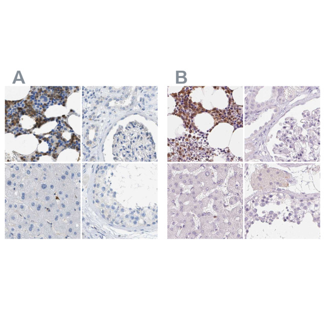 SERPINB1 Antibody in Immunohistochemistry (IHC)
