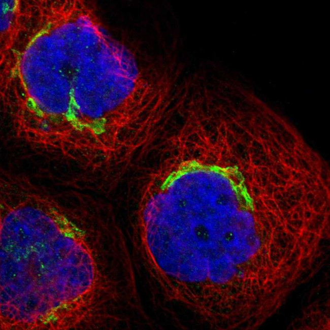 ACCS Antibody in Immunocytochemistry (ICC/IF)