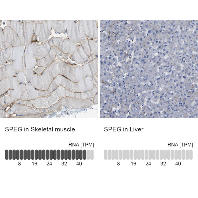 SPEG Antibody in Immunohistochemistry (IHC)