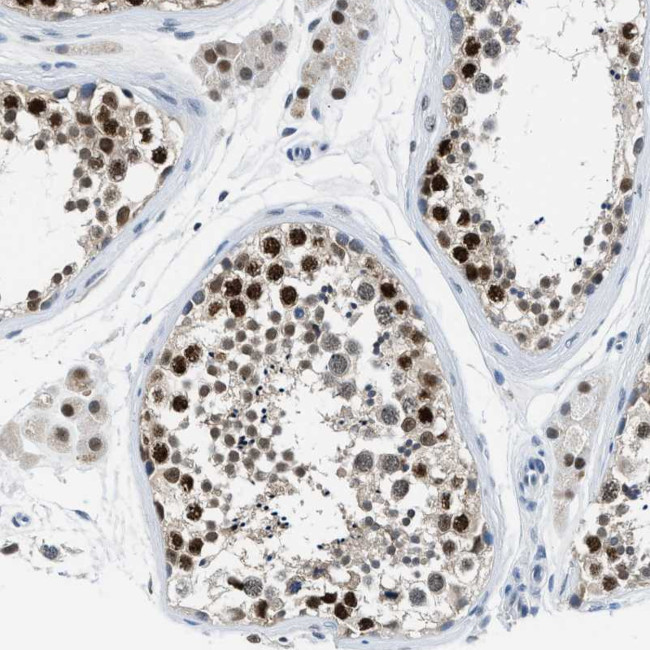 ALX1 Antibody in Immunohistochemistry (Paraffin) (IHC (P))