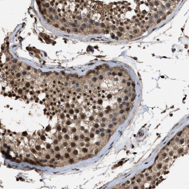 DENND6B Antibody in Immunohistochemistry (Paraffin) (IHC (P))