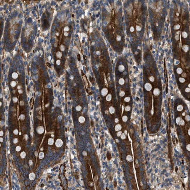 NYNRIN Antibody in Immunohistochemistry (Paraffin) (IHC (P))