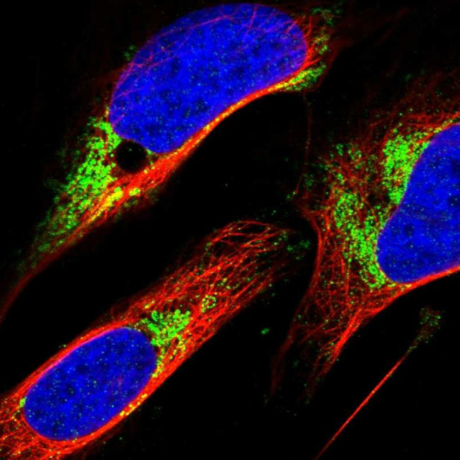 ZNF200 Antibody in Immunocytochemistry (ICC/IF)