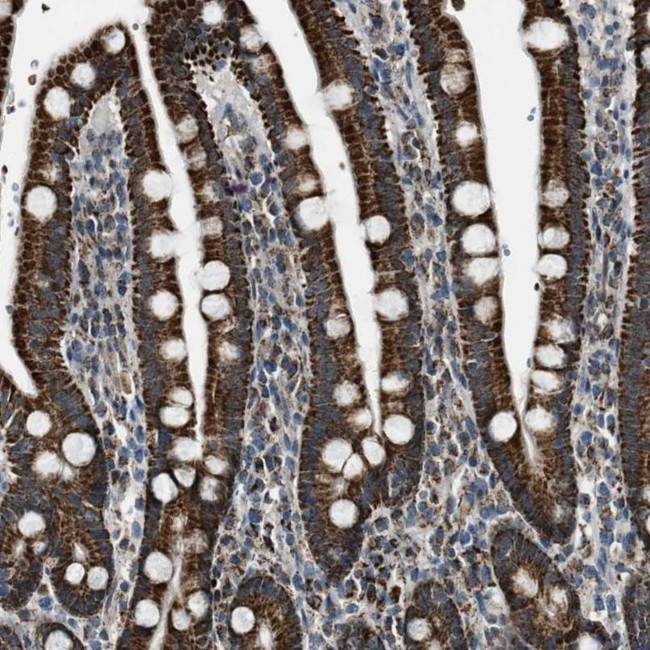 CHN2 Antibody in Immunohistochemistry (IHC)