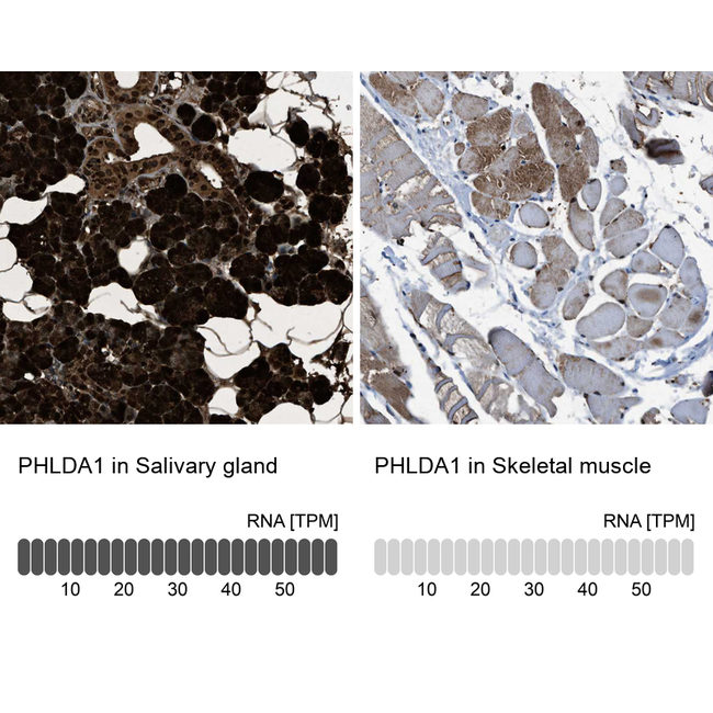 PHLDA1 Antibody in Immunohistochemistry (Paraffin) (IHC (P))