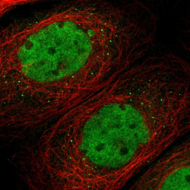 TMEM150A Antibody in Immunocytochemistry (ICC/IF)