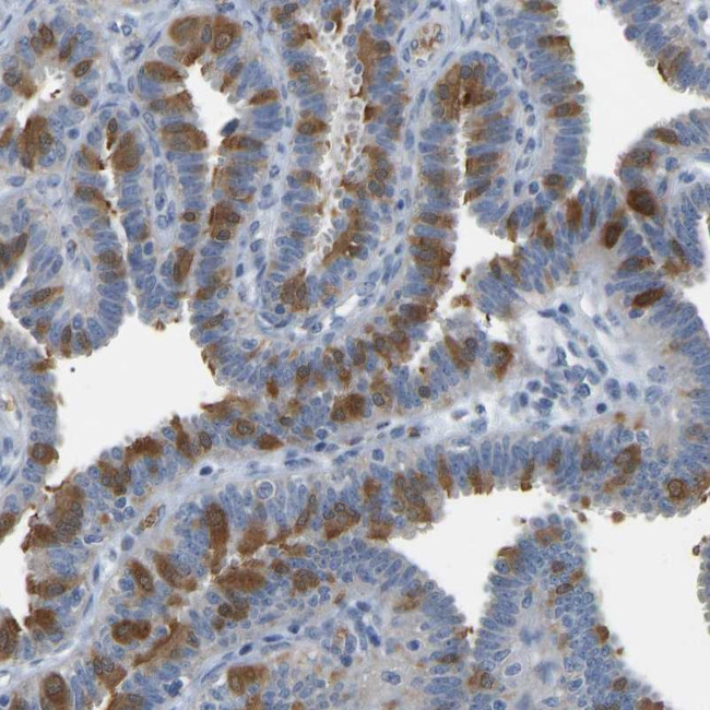C21orf59 Antibody in Immunohistochemistry (Paraffin) (IHC (P))