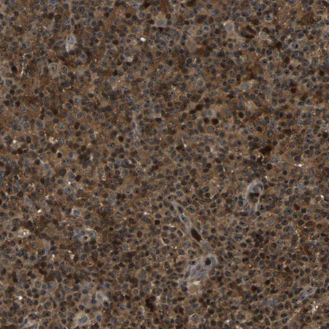 RBM28 Antibody in Immunohistochemistry (Paraffin) (IHC (P))