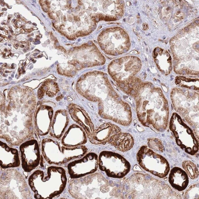 NEK3 Antibody in Immunohistochemistry (IHC)