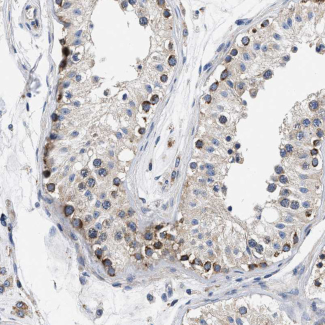 PDP1 Antibody in Immunohistochemistry (Paraffin) (IHC (P))
