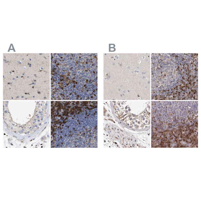 GIMAP4 Antibody in Immunohistochemistry (IHC)