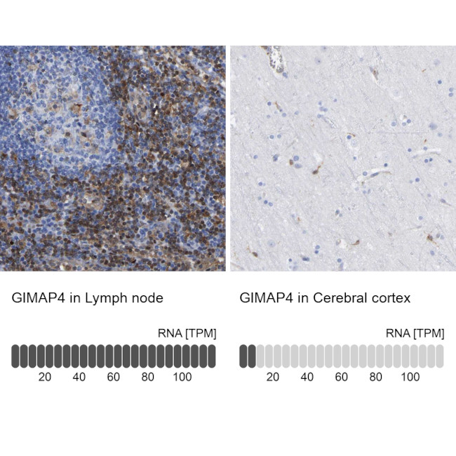 GIMAP4 Antibody in Immunohistochemistry (IHC)