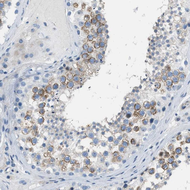 SPATC1L Antibody in Immunohistochemistry (IHC)